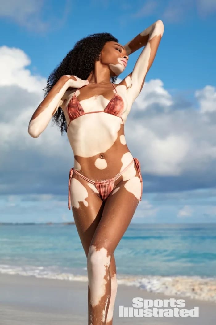 Winnie Harlow stands in front of the ocean wearing a pink tie-dyed string bikini.